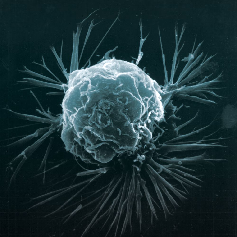 A cancer cell.